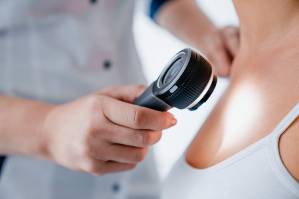 La detección precoz del cáncer de piel es esencial para el éxito del tratamiento